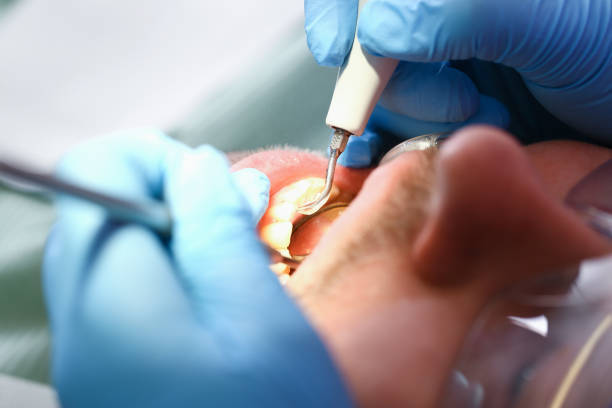 Best Emergency Orthodontic Repairs in St Charles, MN