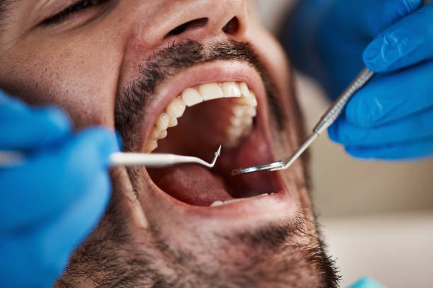 Best Emergency Broken Tooth Repair in St Charles, MN