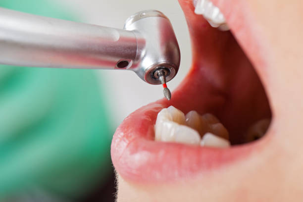 Best Walk-In Emergency Dentist in St Charles, MN